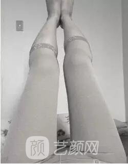东莞缔美陈星光大腿吸脂照片 内附全部恢复过程体验