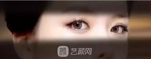 北京艺星整形Yestar分龄祛眼袋真实案例图分享哦~