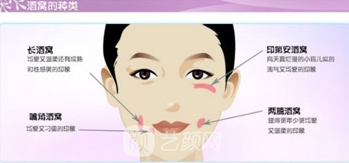 人造酒窝贵吗？需要多少钱?