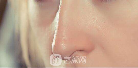 北京做修复鼻子需要多少钱？