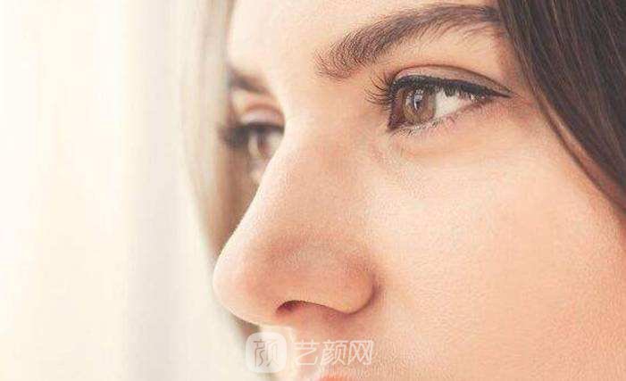 济南自体脂肪隆鼻价钱大概多少?