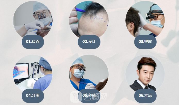 杭州植发手术费用大概多少?