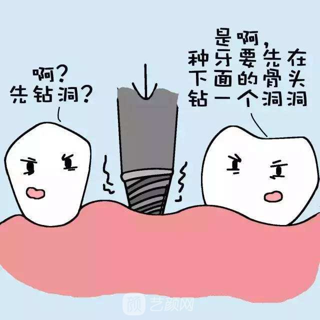 种植牙费用多少