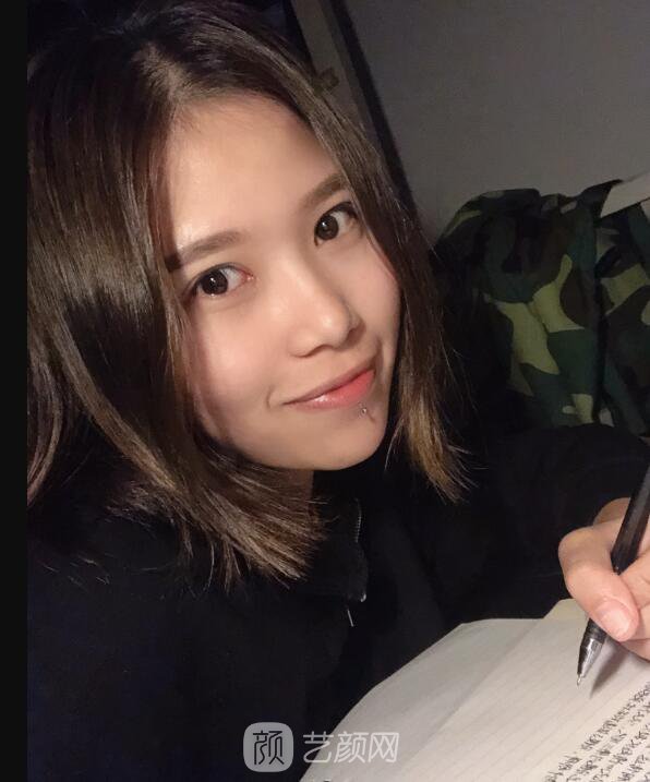 开眼角图真实案例分享哦