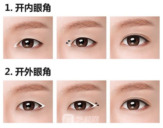 上海韩式开眼角多少钱?