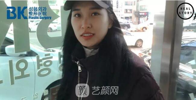 【新西兰美女整形日记】鼻部手术+面部脂肪移植——BK整形医院