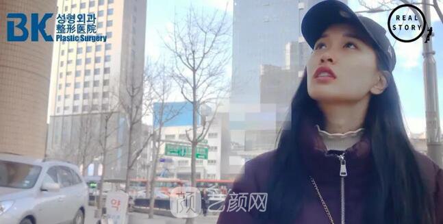 【新西兰美女整形日记】鼻部手术+面部脂肪移植——BK整形医院
