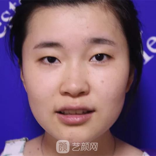 出道三年，她整成这样终于亮相芒果台啦！