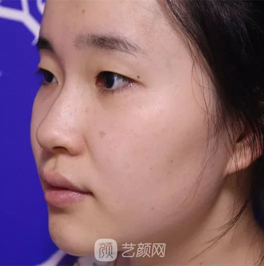 出道三年，她整成这样终于亮相芒果台啦！