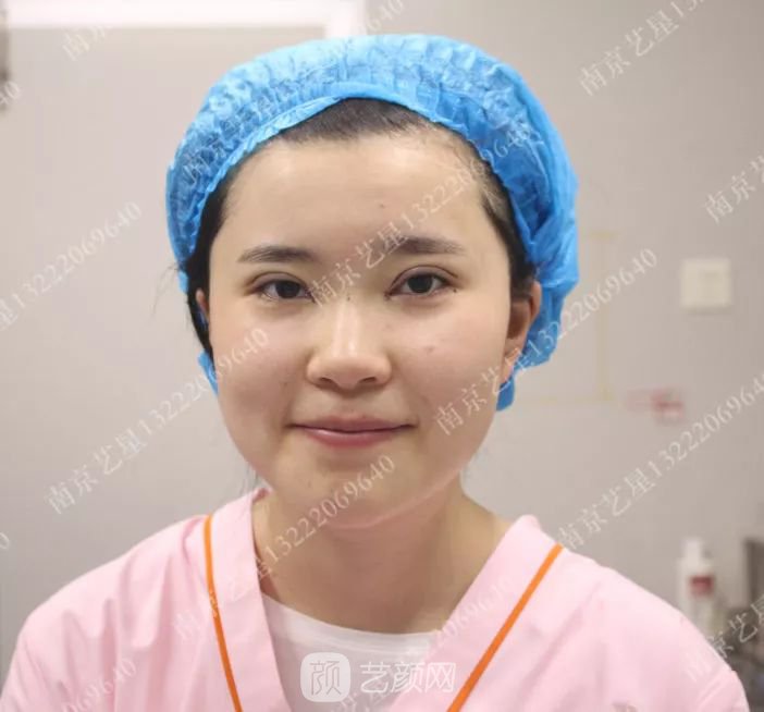 出道三年，她整成这样终于亮相芒果台啦！