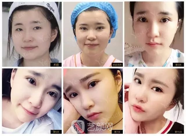 出道三年，她整成这样终于亮相芒果台啦！