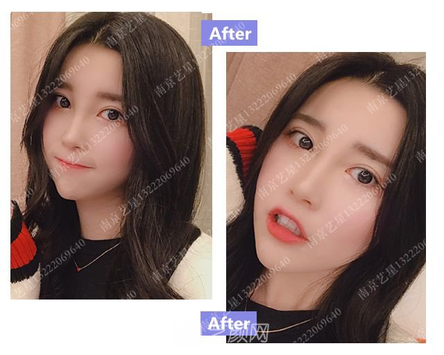 出道三年，她整成这样终于亮相芒果台啦！