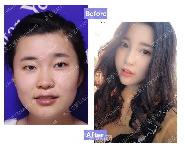 出道三年，她整成这样终于亮相芒果台啦！