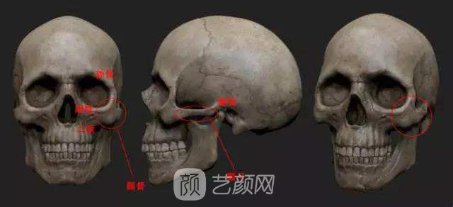 颧骨内推痛吗，听小编来分析