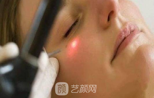 意大利plasma等离子激光光纤溶脂是什么?