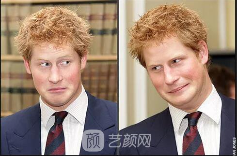 徐峥回应脱发、英国小刺猬因压力大脱毛！不得不说“秃”真是不分界的...