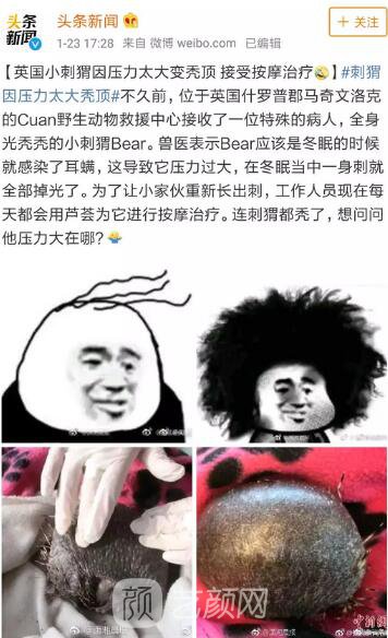 徐峥回应脱发、英国小刺猬因压力大脱毛！不得不说“秃”真是不分界的...