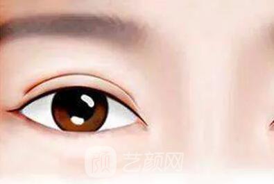 俗话说：三分整形，七分养护!关于术后养护，你做到几分