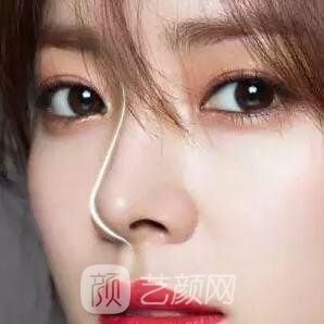 俗话说：三分整形，七分养护!关于术后养护，你做到几分