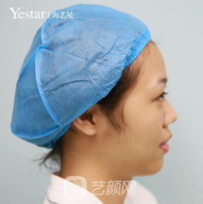 上海艺星切开双眼皮案例，论双眼皮的重要性