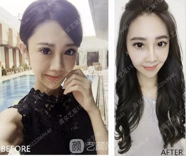 眼霜不管用,拿什么拯救你我的泪沟~