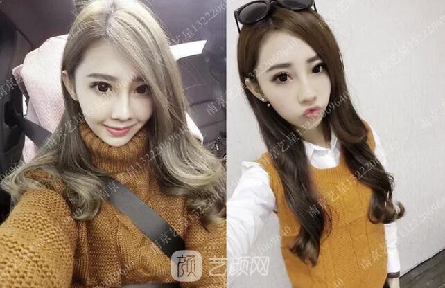 眼霜不管用,拿什么拯救你我的泪沟~