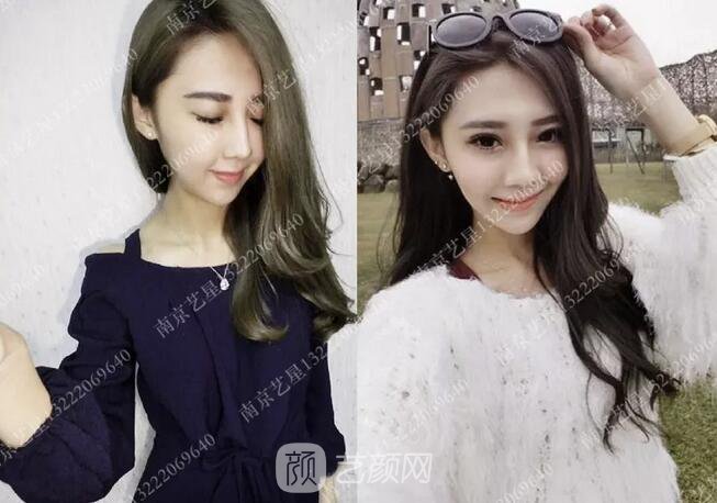 眼霜不管用,拿什么拯救你我的泪沟~