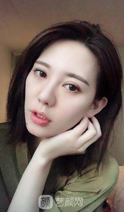 讲个超棒超美的案例