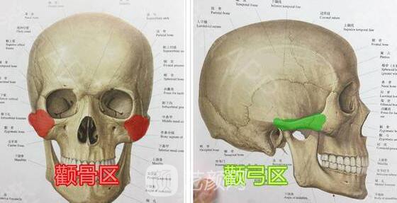 深圳前海联合医院做的颧骨手术屌丝变性感妞