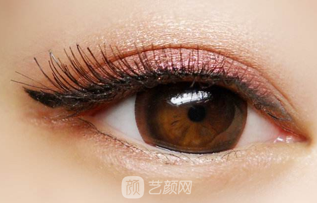 南山医院柯于清谈:割双眼皮有哪些常见问题