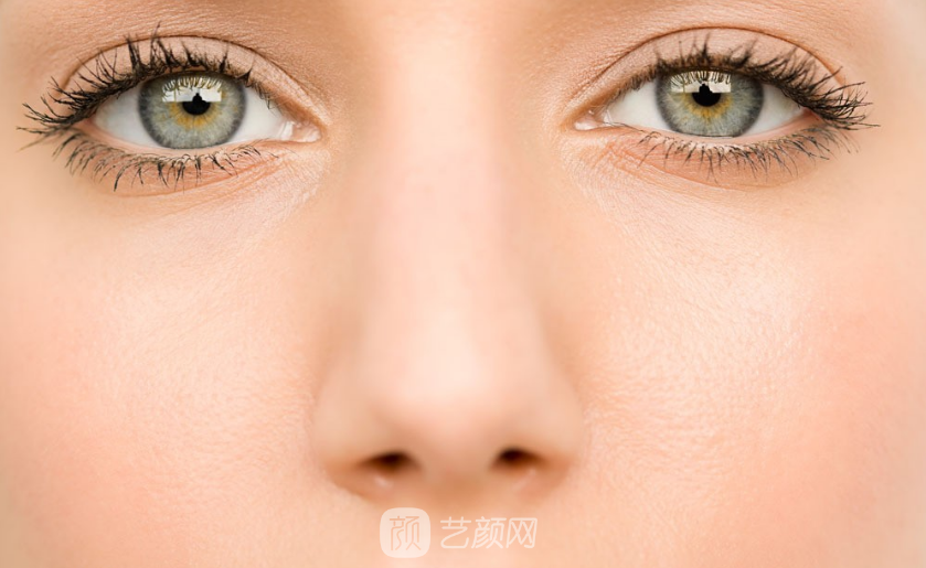 做了眼部+鼻部整形手术让我从丑小鸭变成白天鹅