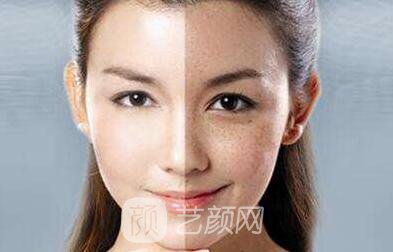 没有斑 男票再也不会嫌弃我了