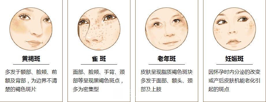 祛斑后不用化妆，我也可以一样美丽。