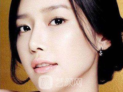 祛斑后不用化妆，我也可以一样美丽。