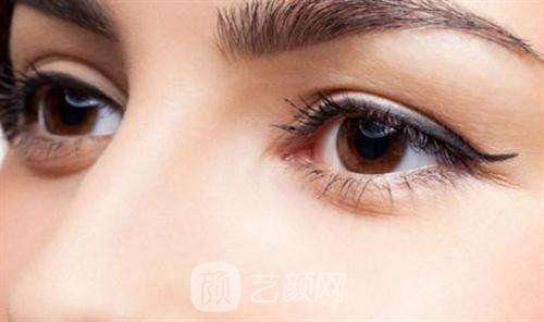 双眼皮术后，必须经历的五个阶段?