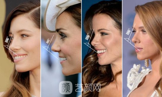 软骨移植重塑鼻尖适应哪些人?