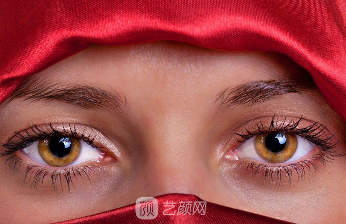 双眼皮案例:从窄双眼皮到宽双眼皮——美,没有界限。