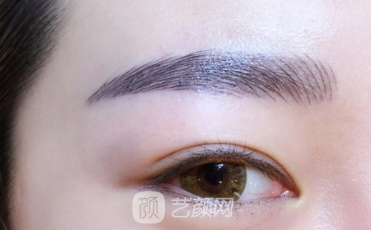 张掖颜艺美整形埋线双眼皮怎么样?