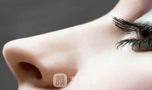 济南隆鼻多少钱哪个医院比较好