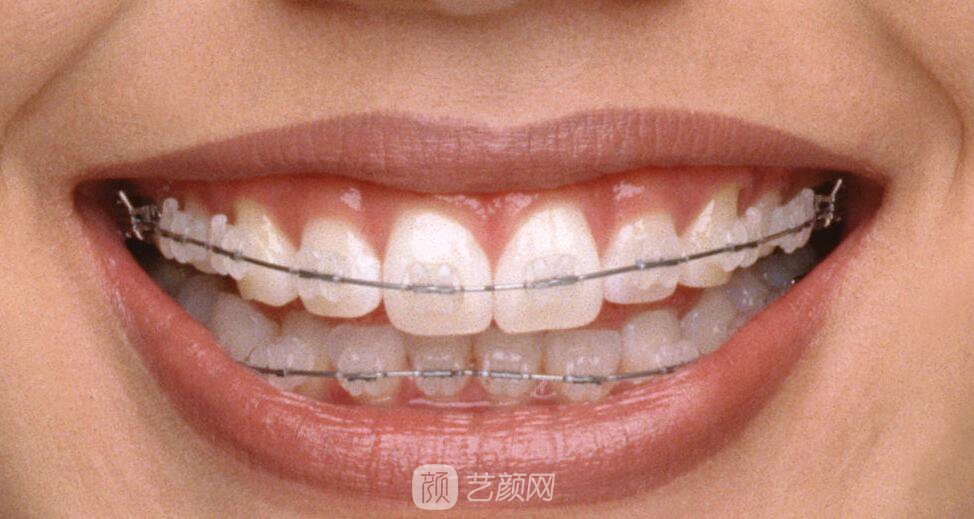 连云港牙齿整形选哪家医院?我们一起来分析一下