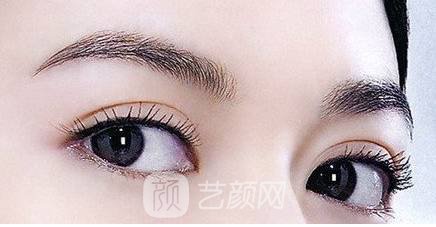 山东滨州双眼皮手术贵吗?多少钱?