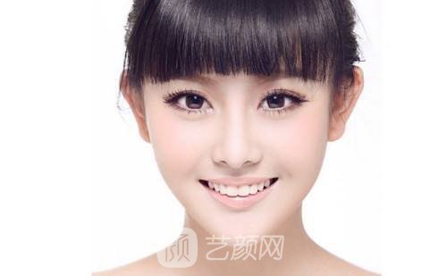 山东滨州双眼皮手术贵吗?多少钱?