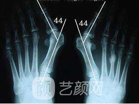 去大脚骨的医院金华有吗?