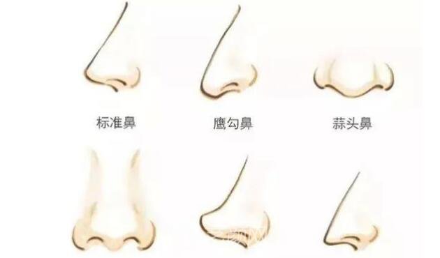 如果你是这几种鼻形，就要矫正啦!