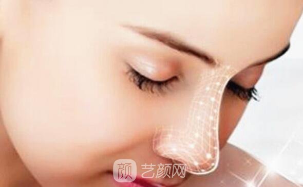 如果你是这几种鼻形，就要矫正啦!