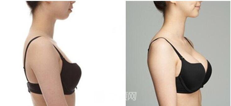 玻尿酸是什么嘛有啥子作用哎