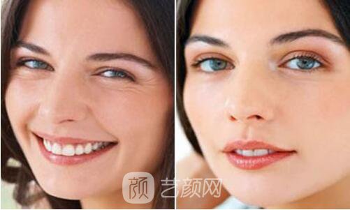 玻尿酸是什么嘛有啥子作用哎