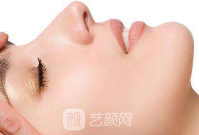 隆鼻案例：隆鼻+双眼皮+下巴已经不是原来自卑的我了~