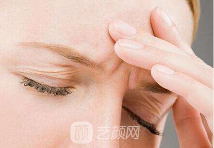 面部去皱术有很多，选适合自己的才是王道