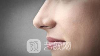 爱贝芙隆鼻后,塌鼻子ByeBye啦!